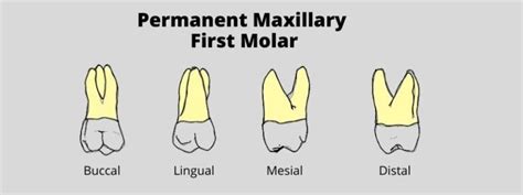 Permanent Maxillary First Molar: Tooth Morphology Made Easy!.